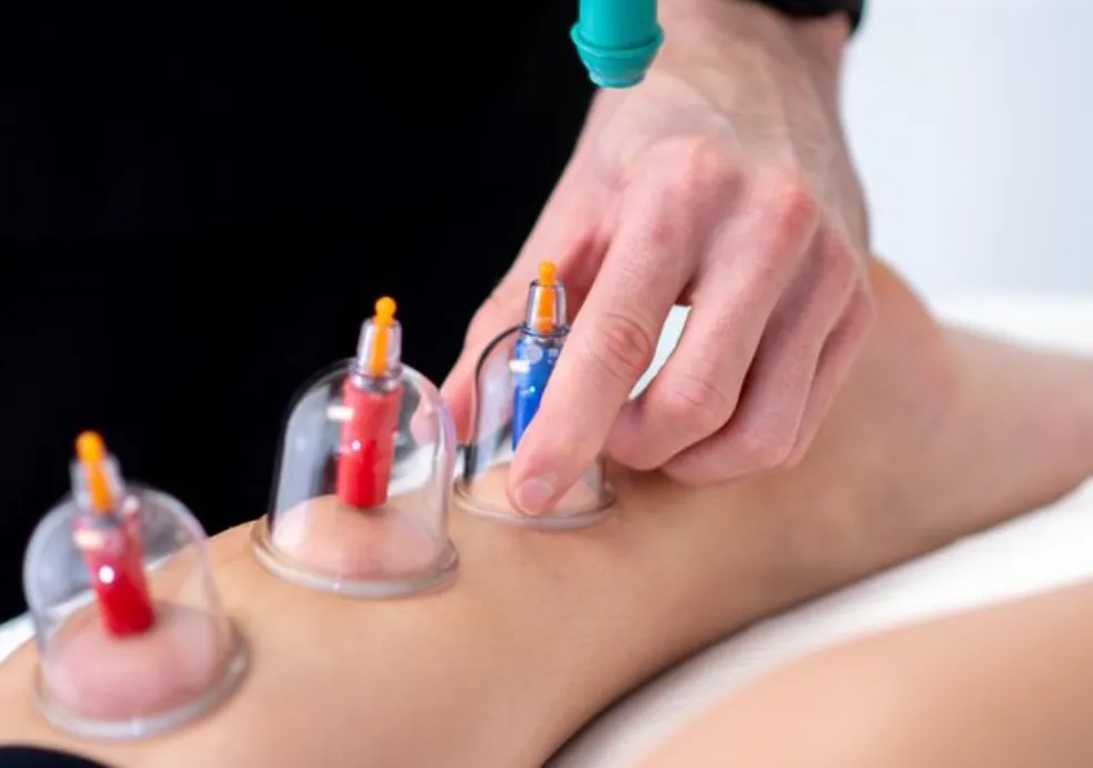 cupping massage near me